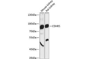 Western blot analysis of extracts of various cell lines, using CDHR5 antibody (ABIN6130563, ABIN6138301, ABIN6138302 and ABIN6217988) at 1:3000 dilution. (CDHR5 抗体  (AA 26-220))