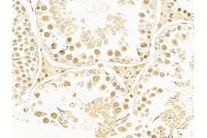 ABIN6263310 and ABIN6273056 at 1/100 staining Rat testis tissue by IHC-P.