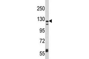Western Blotting (WB) image for anti-Integrin, alpha X (Complement Component 3 Receptor 4 Subunit) (ITGAX) (AA 1119-1145) antibody (ABIN3031404)