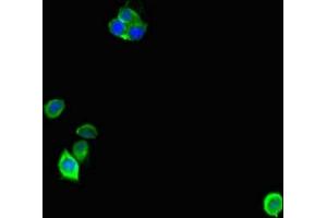 Immunofluorescent analysis of Hela cells using ABIN7143012 at dilution of 1:100 and Alexa Fluor 488-congugated AffiniPure Goat Anti-Rabbit IgG(H+L) (ANP32D 抗体  (AA 1-131))