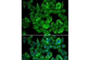 Immunofluorescence analysis of U2OS cells using OGDH Polyclonal Antibody (alpha KGDHC 抗体)