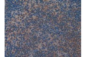 IHC-P analysis of Mouse Spleen Tissue, with DAB staining. (MEK2 抗体  (AA 44-313))