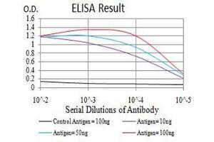 Black line: Control Antigen (100 ng),Purple line: Antigen (10 ng), Blue line: Antigen (50 ng), Red line:Antigen (100 ng) (BRD2 抗体  (AA 227-364))