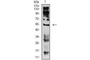 Western Blotting (WB) image for anti-Cholinergic Receptor, Nicotinic, epsilon (Muscle) (CHRNE) (AA 21-239) antibody (ABIN5684150)