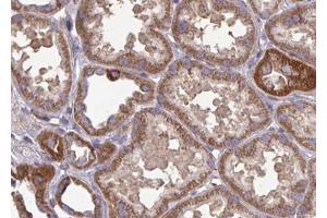 ABIN6266990 at 1/100 staining human kidney tissue sections by IHC-P.