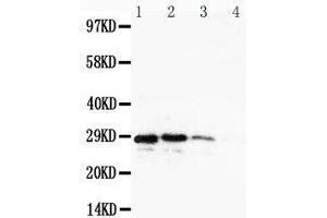 Lane 4: Recombinant Human CuEDC2 Protein 1. (CUEDC2 抗体  (C-Term))