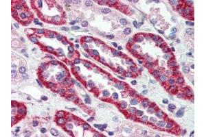 Human Kidney (formalin-fixed, paraffin-embedded) stained with CASRat 15 µg/ml followed by biotinylated goat anti-rabbit IgG secondary antibody, alkaline phosphatase-streptavidin and chromogen. (CASR 抗体  (N-Term))