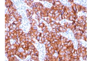 Immunohistochemistry (IHC) image for anti-Receptor tyrosine-protein kinase erbB-2 (ErbB2/Her2) (AA 311-462) antibody (ABIN6939319)