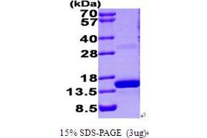 SDS-PAGE (SDS) image for S100 Calcium Binding Protein A9 (S100A9) (AA 1-114) protein (His tag) (ABIN666986) (S100A9 Protein (AA 1-114) (His tag))