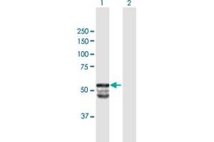 Western Blot analysis of GAL3ST1 expression in transfected 293T cell line by GAL3ST1 MaxPab polyclonal antibody. (GAL3ST1 抗体  (AA 1-423))