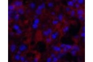 Immunofluorescence analysis of Human appendix tissue using MICU1 Monoclonal Antibody at dilution of 1:200. (MICU1 抗体)