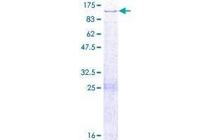 DUS3L Protein (AA 1-650) (GST tag)