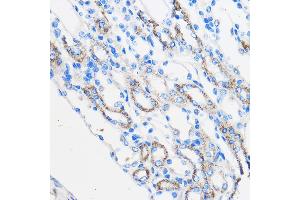 Immunohistochemistry of paraffin-embedded Mouse kidney using R Rabbit pAb (ABIN6131585, ABIN6146704, ABIN6146705 and ABIN6222716) at dilution of 1:50 (40x lens). (Chemerin 抗体  (AA 17-163))
