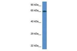 Image no. 1 for anti-TAF6-Like RNA Polymerase II, P300/CBP-Associated Factor (PCAF)-Associated Factor, 65kDa (TAF6L) (AA 180-229) antibody (ABIN6746034)