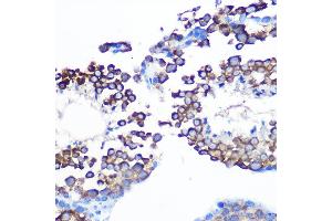 Immunohistochemistry (IHC) image for anti-COP9 Constitutive Photomorphogenic Homolog Subunit 5 (Arabidopsis) (COPS5) antibody (ABIN7266497)