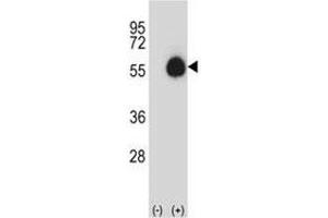 Western blot analysis of CD33 antibody and 293 cell lysate (2 ug/lane) either nontransfected (Lane 1) or transiently transfected (2) with the CD33 gene.