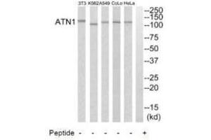 Western blot analysis of extracts from HeLa cells, A549 cells, K562 cells, COLO205 cells and NIH-3T3 cells, using ATN1 antibody. (Atrophin 1 抗体  (N-Term))