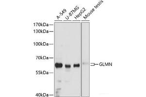 Western blot analysis of extracts of various cell lines using GLMN Polyclonal Antibody at dilution of 1:3000. (GLMN 抗体)