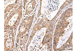 Immunohistochemistry (IHC) image for anti-XK, Kell Blood Group Complex Subunit-Related Family, Member 7 (XKR7) antibody (ABIN7193077)