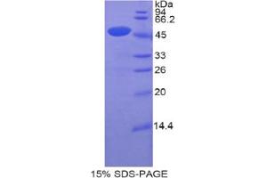 SDS-PAGE analysis of Human CDNF Protein. (CDNF 蛋白)
