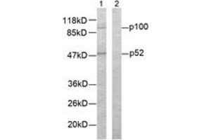 Western blot analysis of extracts from ovary cancer cells, using NF-kappaB p100/p52 (Ab-865) Antibody.