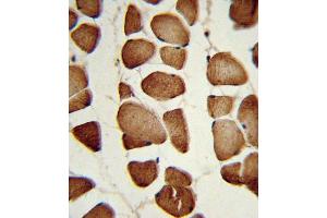 Formalin-fixed and paraffin-embedded human skeletal muscle reacted with NPT Antibody (Center), which was peroxidase-conjugated to the secondary antibody, followed by DAB staining. (NAMPT 抗体  (AA 400-426))