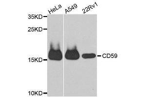 Western blot analysis of extracts of various cell lines, using CD59 antibody. (CD59 抗体  (AA 26-128))