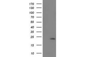 Western Blotting (WB) image for anti-Superoxide Dismutase 2, Mitochondrial (SOD2) antibody (ABIN1499530) (SOD2 抗体)