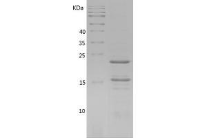 Western Blotting (WB) image for Receptor (TNFRSF)-Interacting serine-threonine Kinase 1 (RIPK1) (AA 292-438) protein (His tag) (ABIN7124799) (RIPK1 Protein (AA 292-438) (His tag))