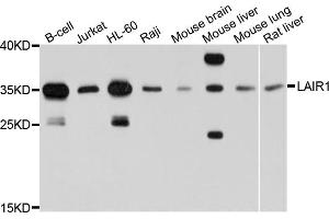 Western blot analysis of extracts of various cell lines, using LAIR1 antibody (ABIN6003818) at 1/1000 dilution. (LAIR1 抗体)