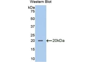 Detection of Recombinant SLPI, Mouse using Polyclonal Antibody to Secretory Leukocyte Peptidase Inhibitor (SLPI) (SLPI 抗体  (AA 20-131))