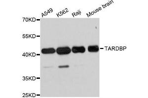 Western blot analysis of extracts of various cell lines, using TARDBP antibody. (TARDBP 抗体)