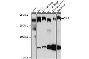 Western blot analysis of extracts of various cell lines, using Slit2 Rabbit mAb (ABIN7270335) at 1:1000 dilution. (SLIT2 抗体)