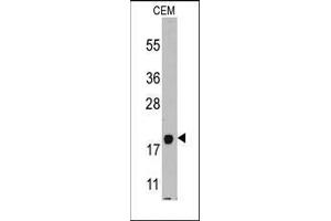 Western blot analysis of anti-PPBP Pab in CEM cell line lysates (35ug/lane). (CXCL7 抗体  (C-Term))