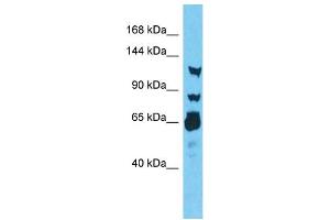Host:  Rabbit  Target Name:  RNF213  Sample Type:  Thyroid Tumor lysates  Antibody Dilution:  1. (RNF213 抗体  (N-Term))