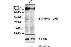 Western blot analysis of extracts of 293 cells, using Phospho-AMPKβ1-S108 antibody (ABIN6135184, ABIN6136014, ABIN6136015 and ABIN6225614) at 1:1000 dilution. (PRKAB1 抗体  (pSer108))