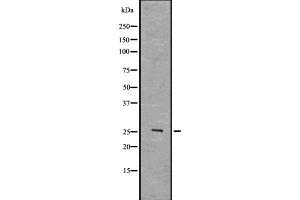 Western blot analysis of SOD-3 using HuvEc whole  lysates. (SOD3 抗体  (Internal Region))