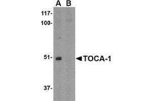 Western blot analysis of TOCA-1 in mouse brain tissue lysate with in (A) the absence and (B) the presence of blocking peptide with this product at 1 μg/ml.