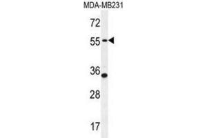 Western Blotting (WB) image for anti-Phosphodiesterase 12 (PDE12) antibody (ABIN2995597) (PDE12 抗体)