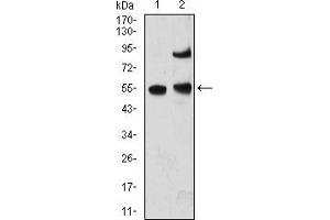 Western blot analysis using MECP2 mouse mAb against A431 (1) and MCF-7 (2) cell lysate. (MECP2 抗体  (AA 7-148))