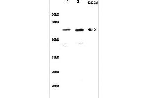 Lane 1: rat brain lysates Lane 2: mouse embryo lysates probed with Anti CKAP4 Polyclonal Antibody, Unconjugated  at 1:200 in 4˚C. (CKAP4 抗体  (AA 525-602))