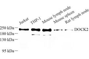 Western blot analysis of DOCK2 (ABIN7073706) at dilution of 1: 500 (DOCK2 抗体)