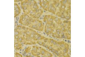 Immunohistochemistry (IHC) image for anti-Monoamine Oxidase A (MAOA) (AA 1-260) antibody (ABIN3021916)