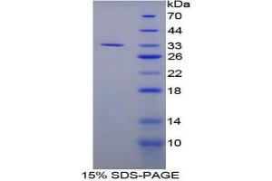 SDS-PAGE analysis of Mouse LOX1 Protein. (OLR1 蛋白)