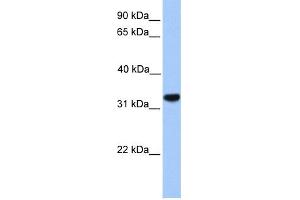 WB Suggested Anti-CACNG4 Antibody Titration:  0. (CACNG4 抗体  (N-Term))