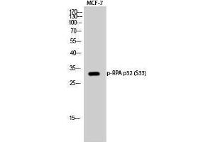 Western Blotting (WB) image for anti-Replication Protein A2, 32kDa (RPA2) (pSer33) antibody (ABIN3173126) (RPA2 抗体  (pSer33))