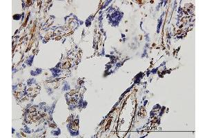 Immunoperoxidase of monoclonal antibody to DKK1 on formalin-fixed paraffin-embedded human placenta. (DKK1 抗体  (AA 1-266))