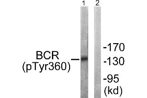 Immunohistochemistry analysis of paraffin-embedded human brain tissue using Bcr (Phospho-Tyr360) antibody. (BCR 抗体  (pTyr360))