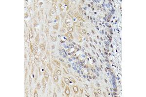 Immunohistochemistry (IHC) image for anti-Thyroid Hormone Receptor Interactor 4 (TRIP4) (AA 282-581) antibody (ABIN7270824)
