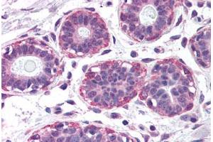 Human Breast (formalin-fixed, paraffin-embedded) stained with NET1 antibody ABIN299308 at 2. (NET1 抗体  (AA 396-409))
